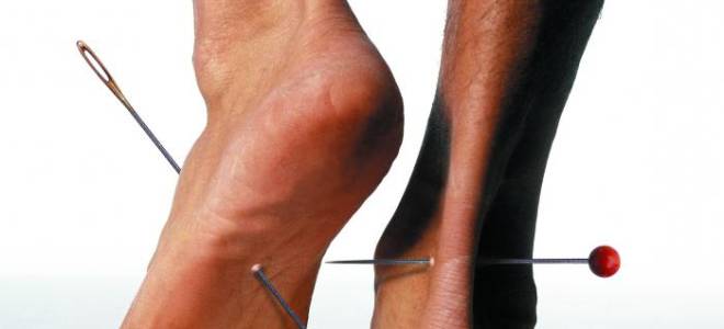 Слабость покалывание в руках и ногах