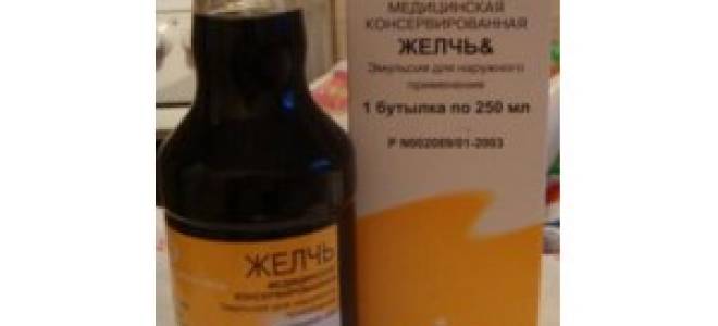 Пяточная шпора лечение желчью медицинской отзывы