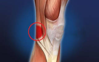 Болит с обратной стороны колена