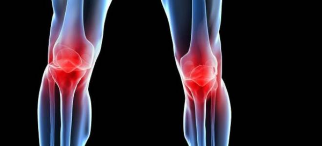Гонартроз коленного сустава 1 степени лечение народными средствами