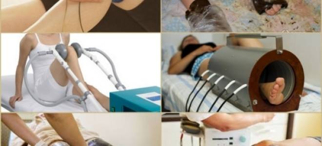 Как выглядит колено с жидкостью?