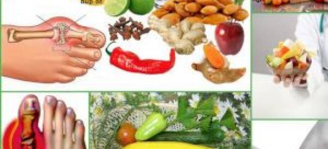 Что можно кушать при подагре и что нельзя список продуктов таблица?