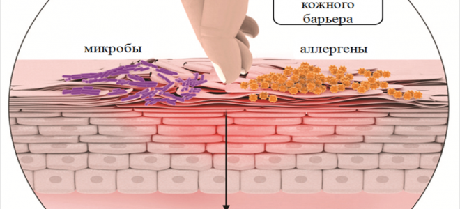 Экзема фото симптомы и лечение у взрослых на ногах