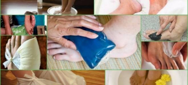 Компрессы при подагре на ногах