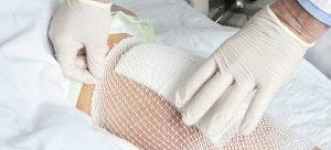 Колено опухло покраснело и болит