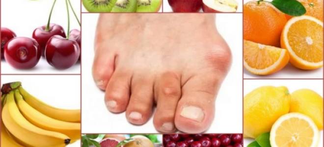 Можно ли есть арбуз при подагре на ногах?