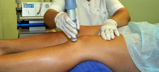 Электрофорез коленного сустава при артрозе